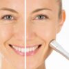 Beurer FC 100 Pureo Derma Peel uređaj za mikrodermoabraziju - Slika 2
