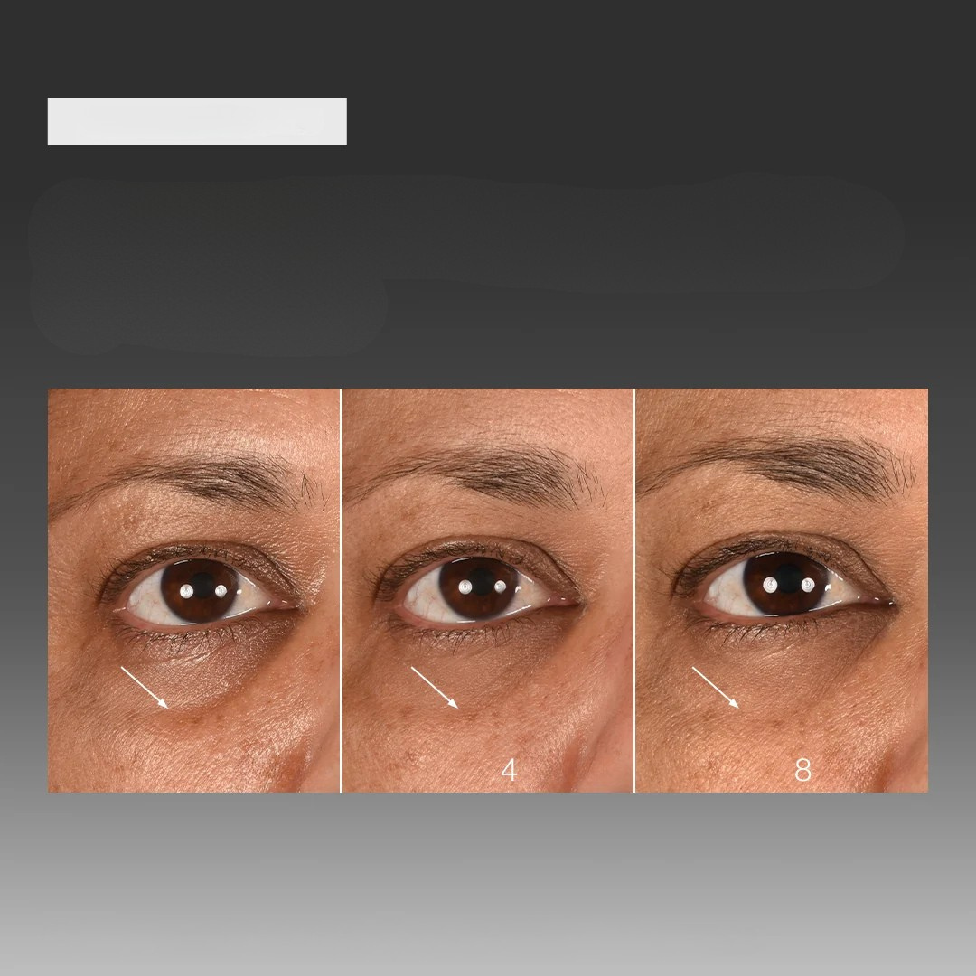 Dermalogica Smart Eye Density 15 ml - Slika 2